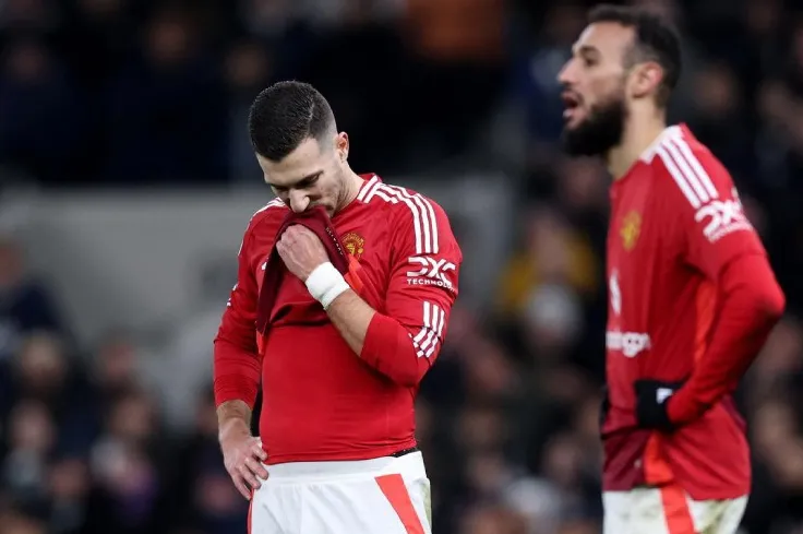 Các cầu thủ MU ngao ngán với hệ thống 3-4-2-1